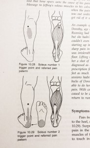 Trigger point therapy for calf muscles