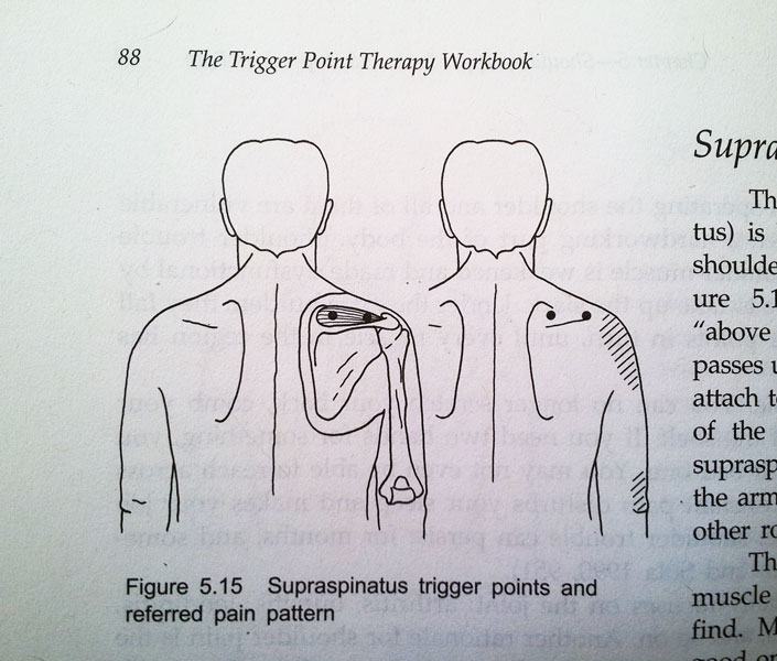 Trigger Point Therapy Workbook Review